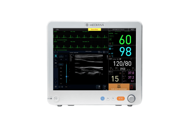 Ultrasound & Patient Monitoring System