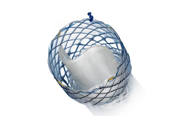 Hanarostent® Valve