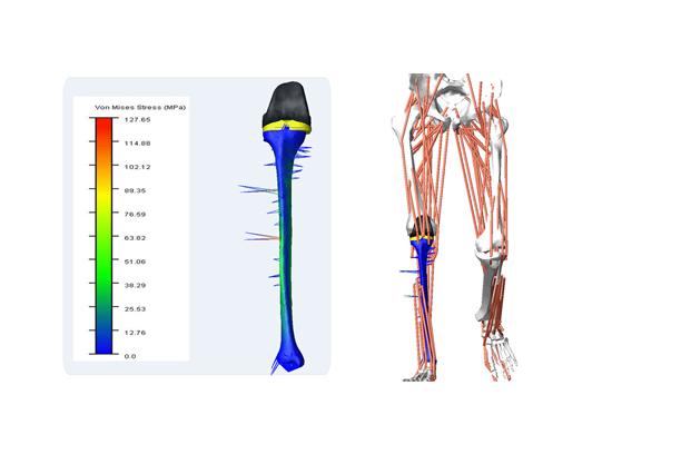 Medical Devices